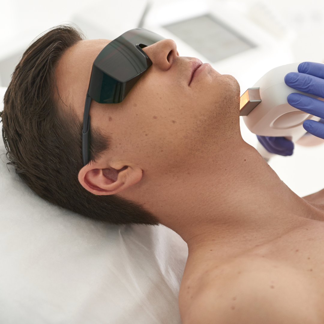 Láser Bioestimulación Facial 1 Sesión