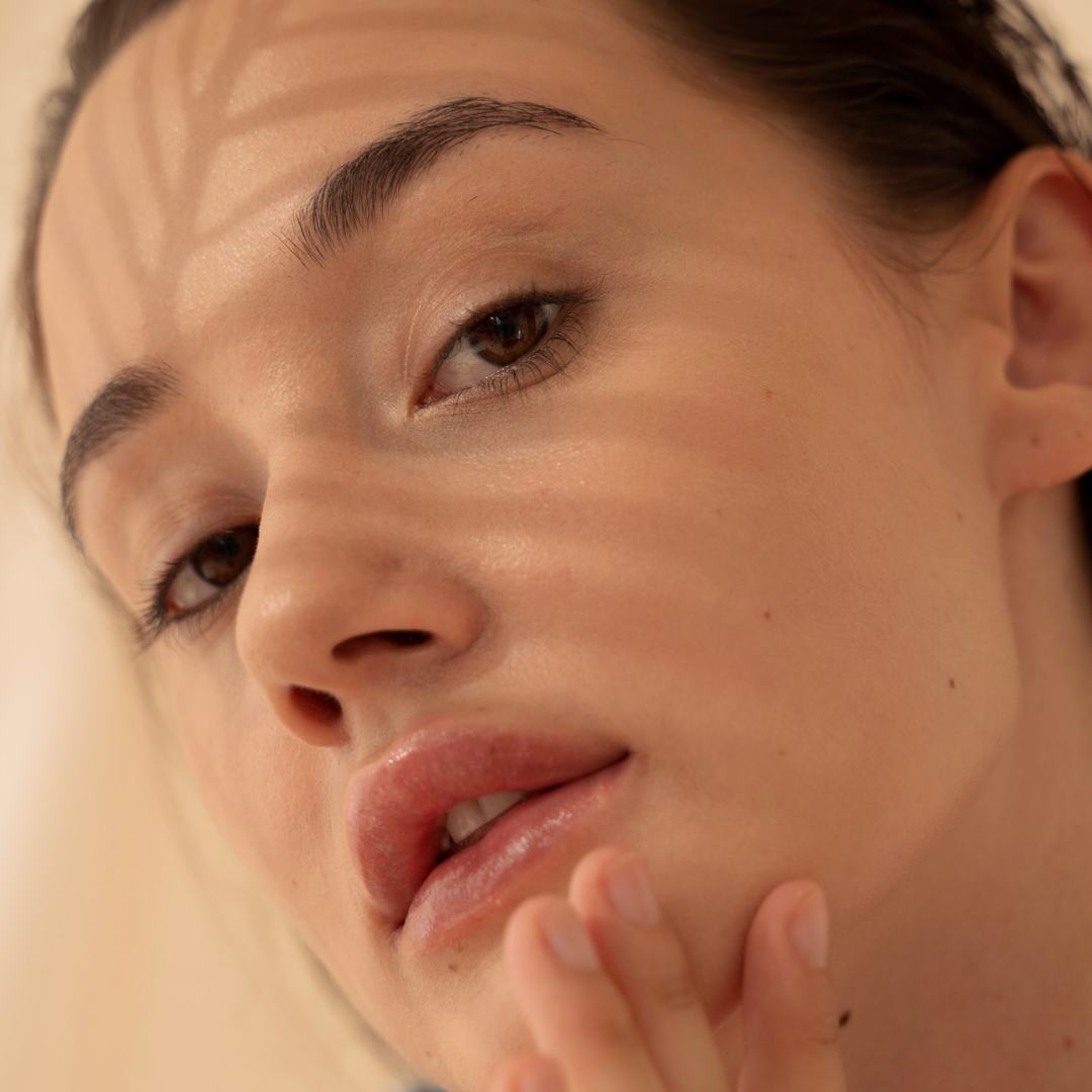 Láser fotona para Telangectasia Facial 1 Sesión